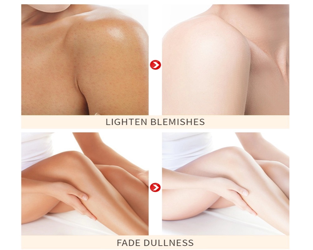 body lotion before after rough knees